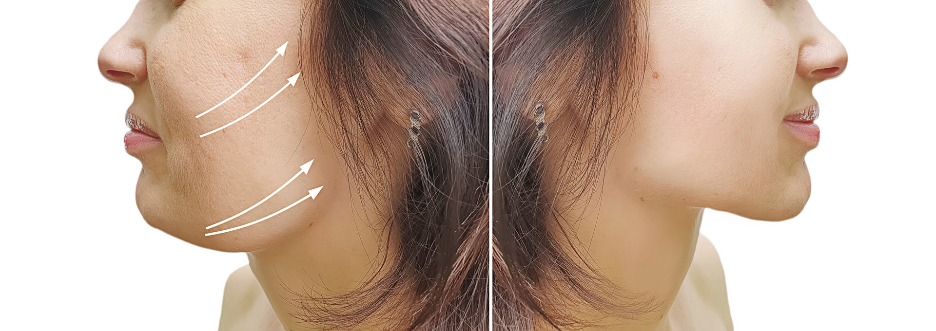 Gangnamseoyon Plastic Surgery