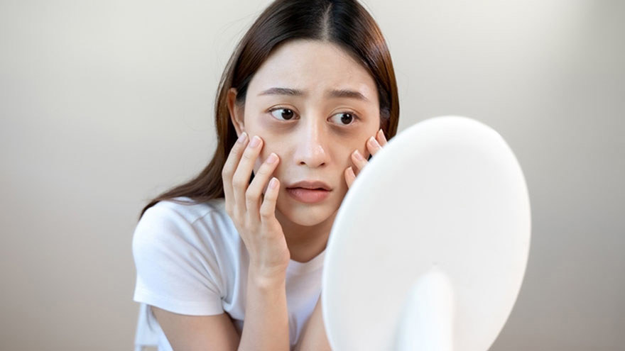 Bruising After Facial Surgery