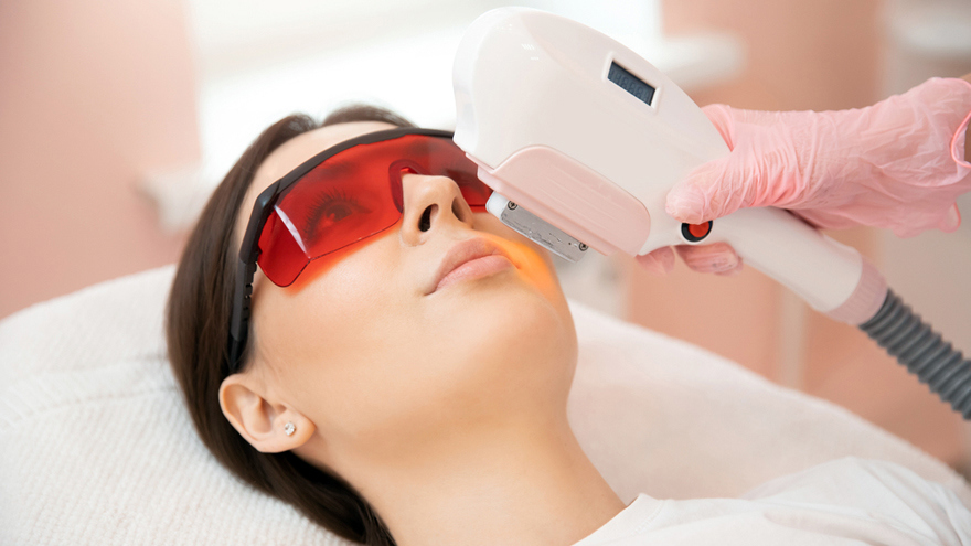 Cellas Laser Treatment
