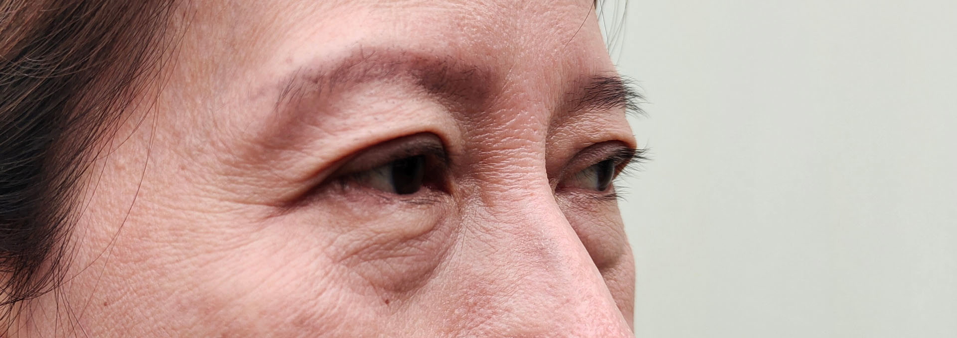 Gangnamseoyon Plastic Surgery