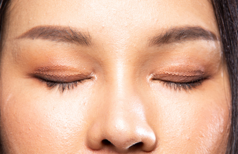 Double Eyelid Revision