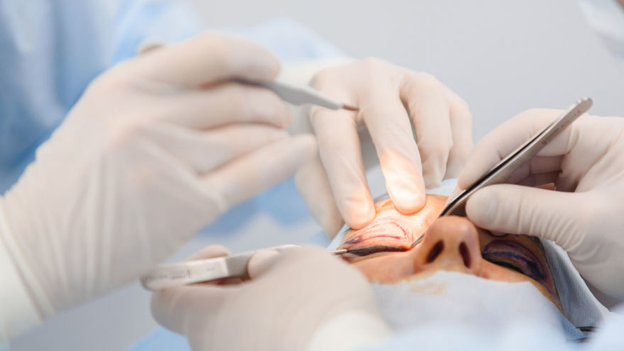 Eyelid Surgery
