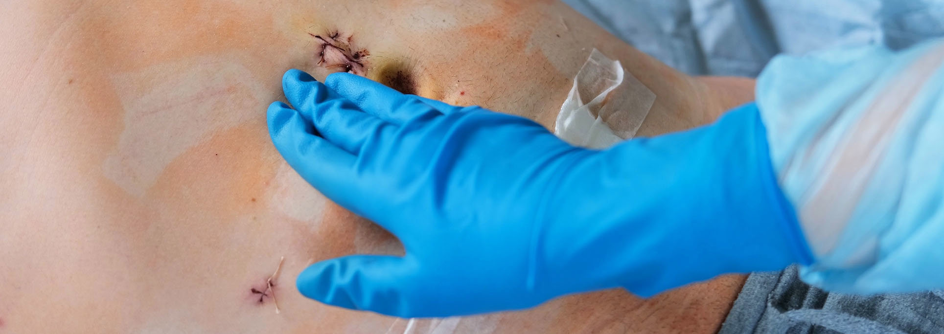 Gangnamseoyon Plastic Surgery